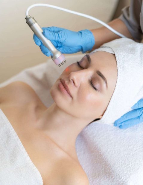 Gesichtsbehandlung Anti-Aging, Microneedling, dermabrasion in zürich, Opfikon, Höngg, Affoltern, Oerlikon bild